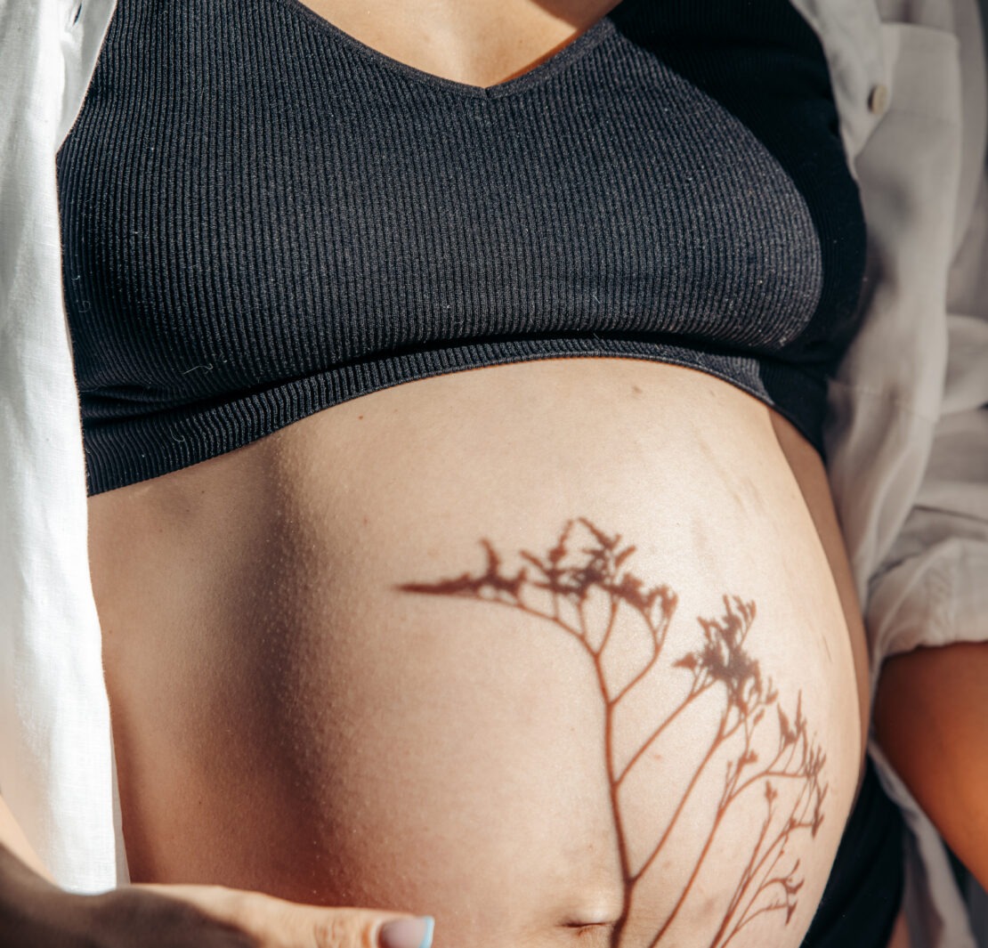 best lotions pregnant women